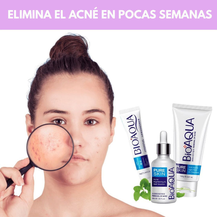 Kit Anti Acné De Bioaqua 3 en 1